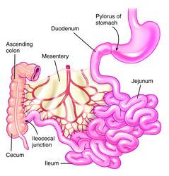 Perforation Of The Small And Large Intestine