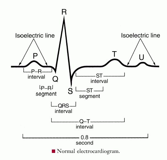 full-size-picture-electrocardiogram-jpg