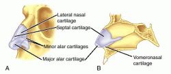 major alar cartilage