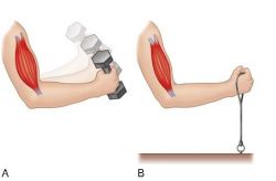 What is an isotonic contraction?