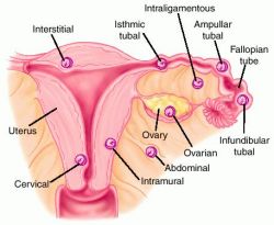 pregnant pig uterus