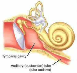 Pharyngostomy Tube