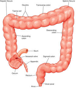 What is a hepatic flexure polyp?