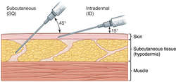 Vastus lateralis injection steroids