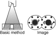 radiography