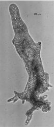Phase-contrast photomicrograph of Amoeba proteus , a large fresh-water ameba