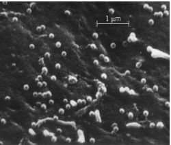 Scanning electron micrograph of the surface of a mouse cell infected with murine leukemia virus