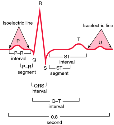 ekg pulseless electrical activity