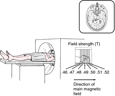 claustrophobia definition. If patients are susceptible to claustrophobia or cannot tolerate the tedium 