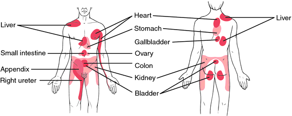 Referred pain | definition of referred pain by Medical dictionary