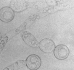 Yeast Candida Albicans