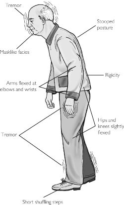 What are examples of sporadic disease?