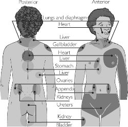 Angina Definition