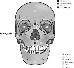 Zygomaticomaxillary 