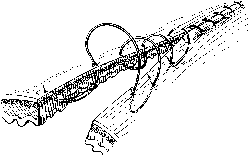 connell suture pattern