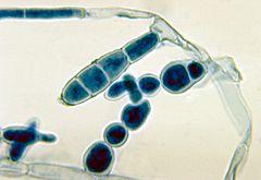 Epidermophyton floccosum 01.jpg