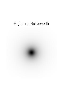 Highpass Butterworth Checkerboard.png