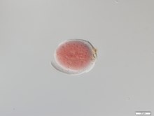 Collection Penard MHNG Specimen 487-4-2 Lieberkühnia wagneri.tif