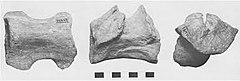 Pneumatoarthrus vertebrae.jpg