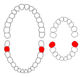 Mandibular second molars01-01-06.png