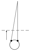Exotropia