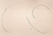 Dracunculus medinensis larvae.jpg