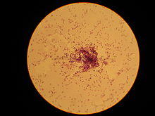 Lactococcus lactis.jpg