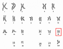 Human male karyotpe high resolution - Chromosome 18.png