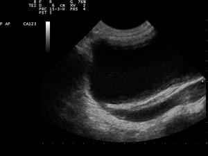 Ultrasound Scan ND 0119092150 0939241.png
