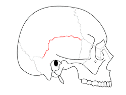 SchaedelSeitlichSutur3 - Squamosal suture.png