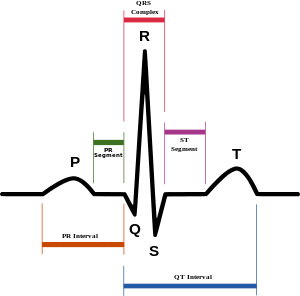 SinusRhythmLabels.svg