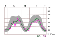 TSNIT graph