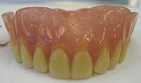 Mr M's Complete Denture2.jpg