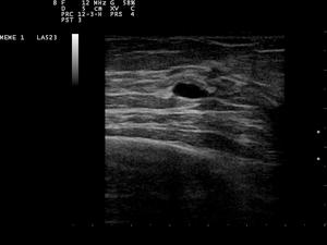 Ultrasound Scan ND 0112144335 1445010.png