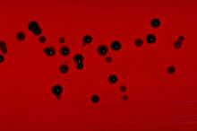Chromobacterium violaceum blood agar.jpg