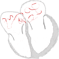 Heart conduct atrialfib.gif