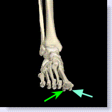 Sesamoid-skeletalfront.gif