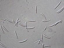 Fusarium solani (Mart.) Sacc. 5393379.jpg