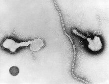 Transmission electron micrograph of a parainfluenza virus. Two intact particles and free filamentous nucleocapsid