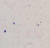 A few large, spherical, purple bacteria in small clusters on a faded pink background