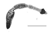 Echinococcus multilocularis.jpg