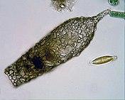 Shell of the testate amoeba Difflugia acuminata