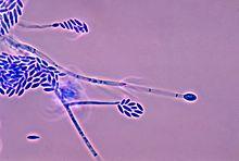Fusarium verticillioides 01.jpg