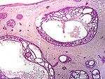 SkinTumors-P7240520.jpg
