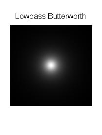 Lowpass Butterworth Checkerboard.png