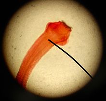 Taenia scolex cropped.jpg