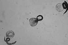 Baylisascaris larvae.jpg