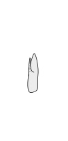 Crustacean antenna - Remipedia Speleonectes tanumekes 2nd-antenna.svg
