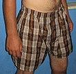 Boxer shorts