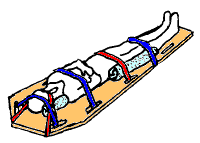 Immobilisation plan dur.png